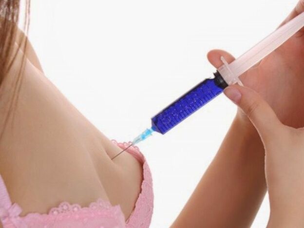 Inxeccións de ácido hialurónico para o aumento da mama