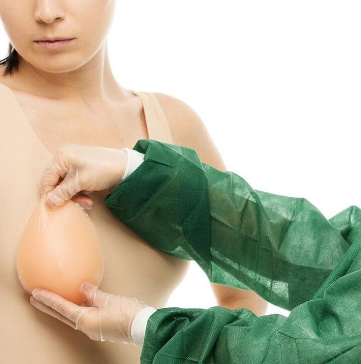 Implantes de aumento de mama